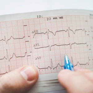 ECG Basic Interpretation